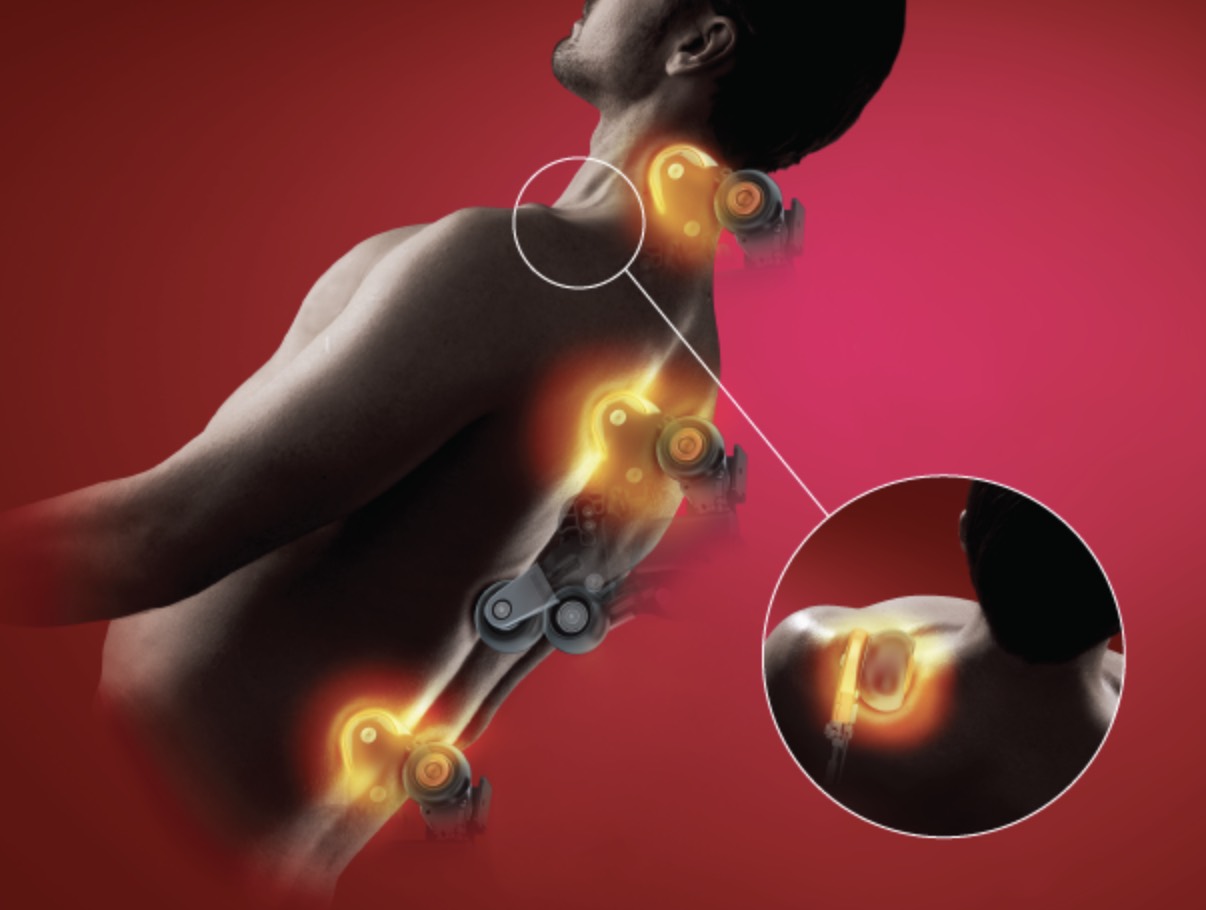 La détection de morphologie, le scan, le sensor, qu'est-ce que c'est ? 2